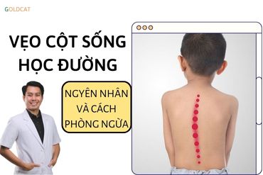 Vẹo cột sống học đường nguyên nhân và cách phòng ngừa