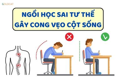 Ngồi học sai tư thế nguyên nhân gây cong vẹo cột sống ở trẻ em