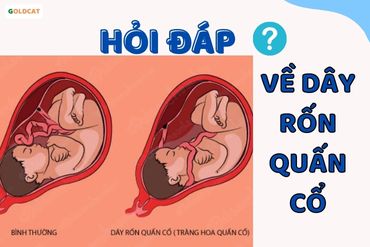 Tổng hợp những câu hỏi về dây rốn quấn cổ mà mẹ bầu cần biết