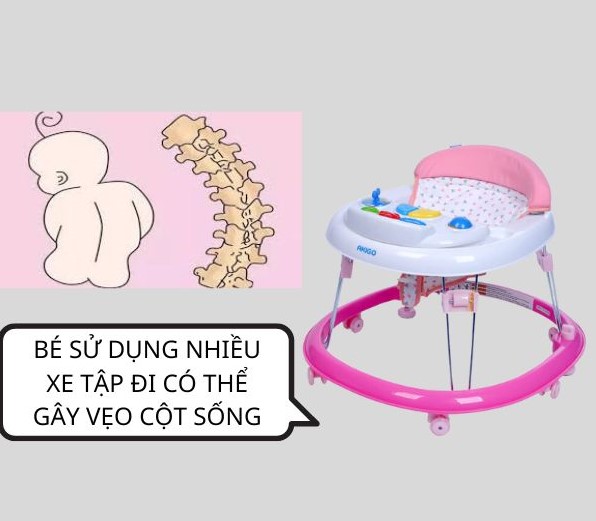 trẻ em bị cong vẹo cột sống