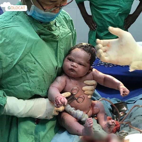 những ảnh hưởng khi sinh mổ