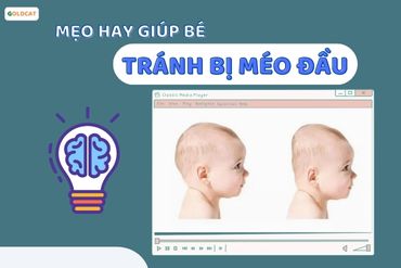 Các phương pháp tránh tình trạng trẻ bị lõm đầu sơ sinh