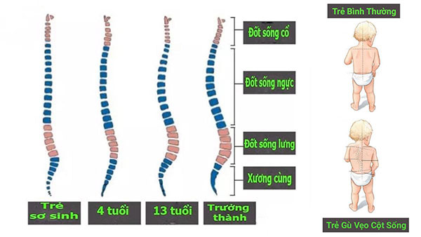 phát triển cột sống của trẻ sơ sinh