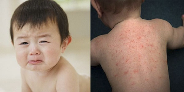 đệm sơ dừa gây dị ứng da bé