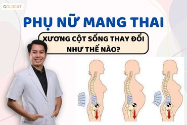 Xương cột sống phụ nữ mang thai sẽ thay đổi như thế nào